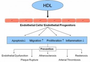 HDL