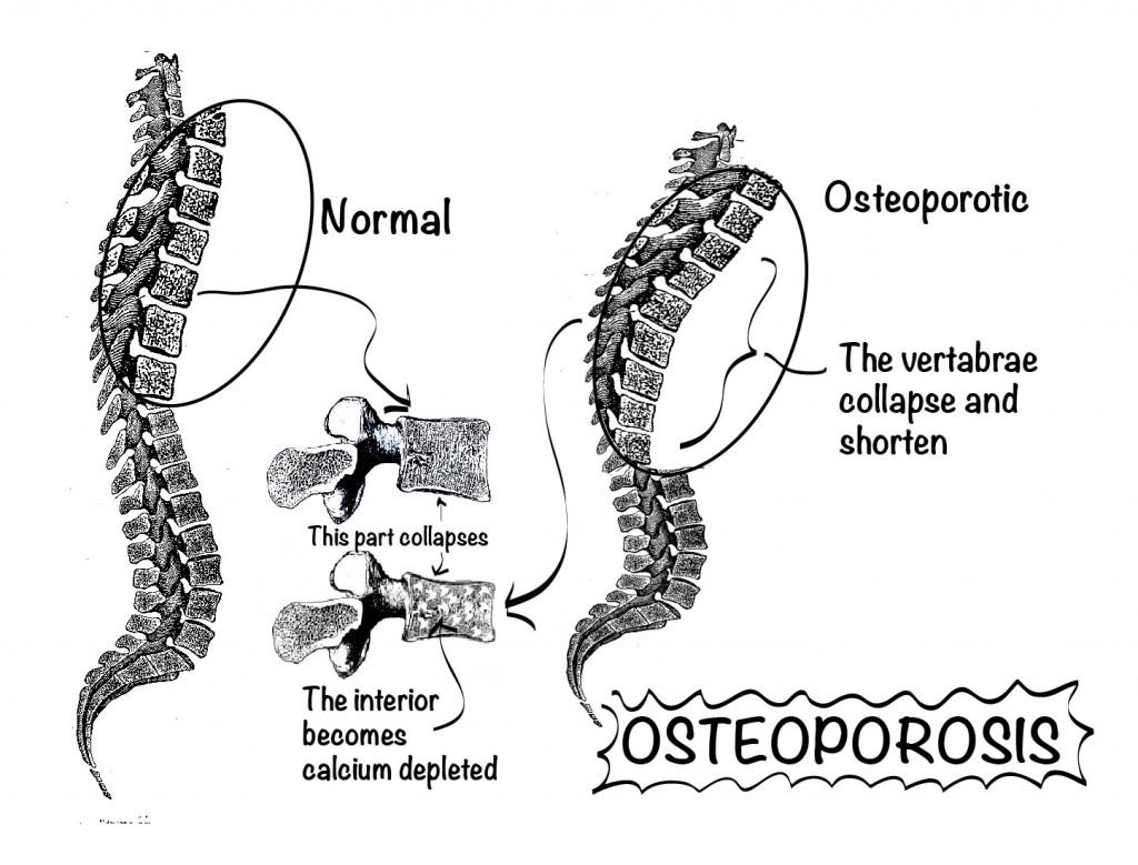 spine-7-01